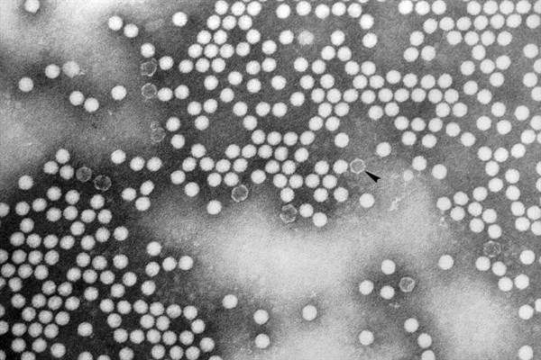 0227 Poliovirus Type 1